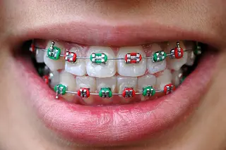 Invisalign Near Me