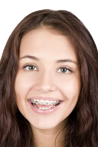 Invisalign Near Me