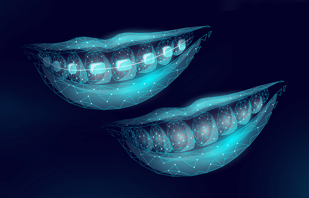 We Look At The Pros And Cons Of Invisalign Vs. Braces