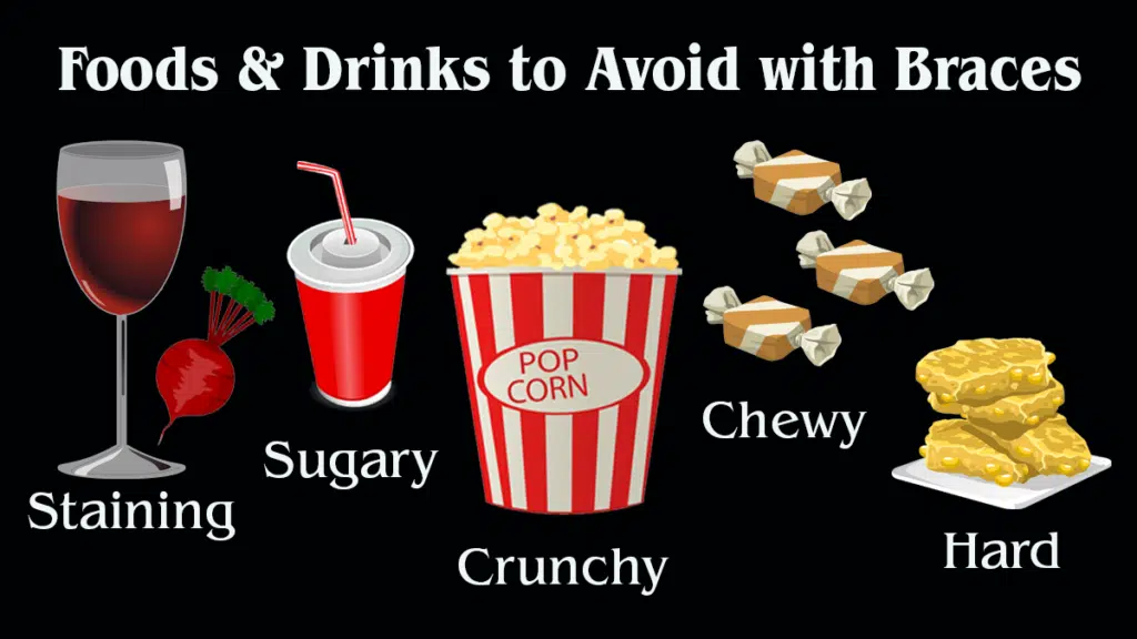 Foods & Drinks to Avoid with Braces