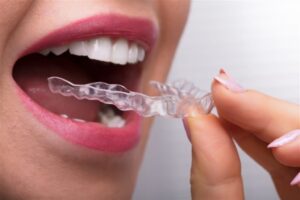 how long does Invisalign take to work