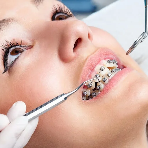 Mri Scan Precautions For Patients With Braces